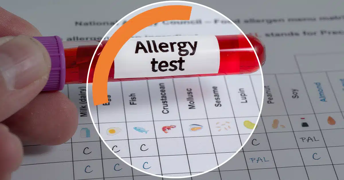 Why a positive food allergy test doesn’t always mean your child has an allergy.